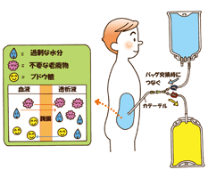 腹膜透析治療　図2
